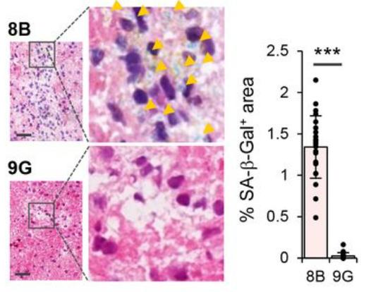 The macrophages did indeed age