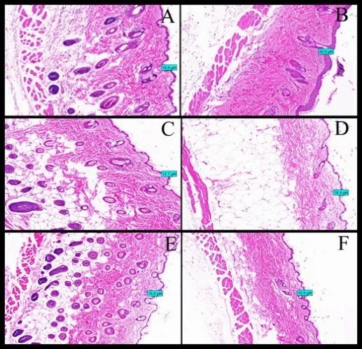 Figure: HE staining results of mouse skin sections