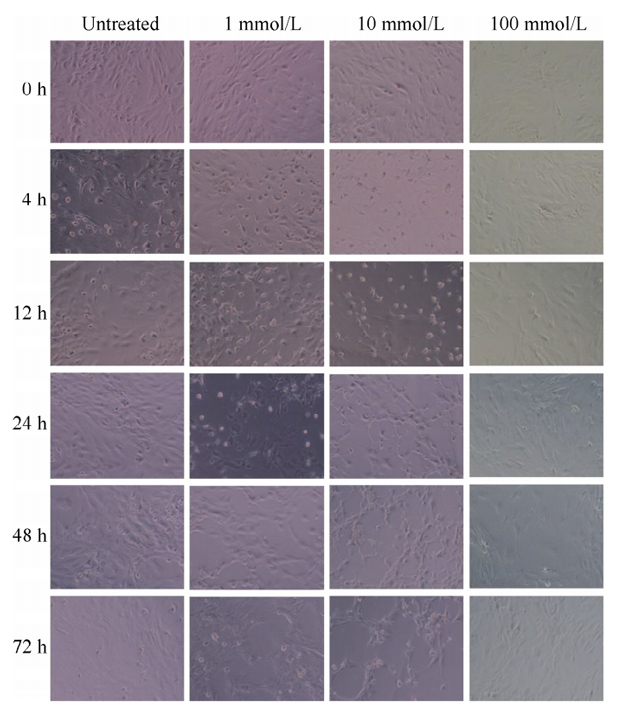 Effect of glutathione at different concentrations on the morphology of lung fibroblasts