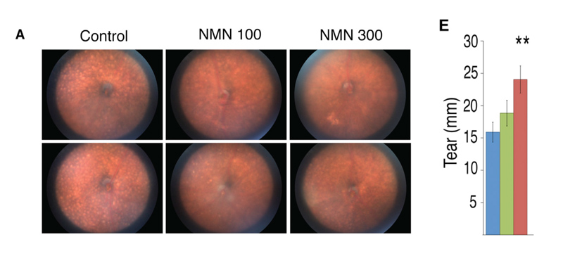 NMN can improve eye aging in many ways